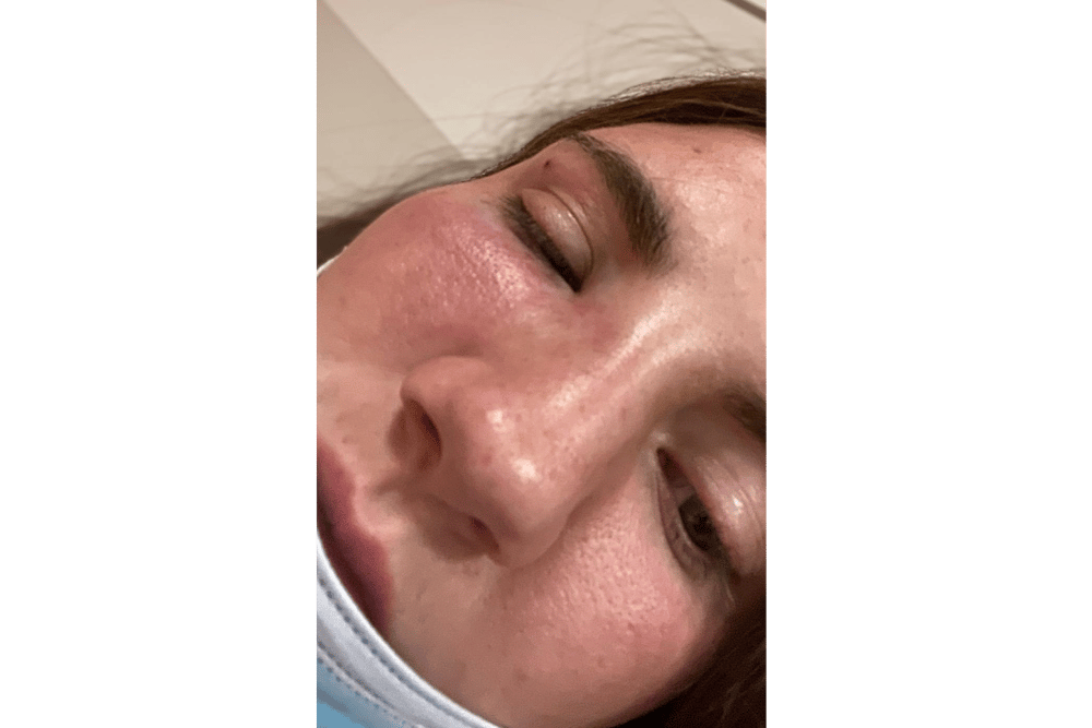 Natasha O’Brien, 24, sustained a broken nose, concussion, swelling and bruising during the attack on O’Connell Street, Limerick on May 29, 2022
