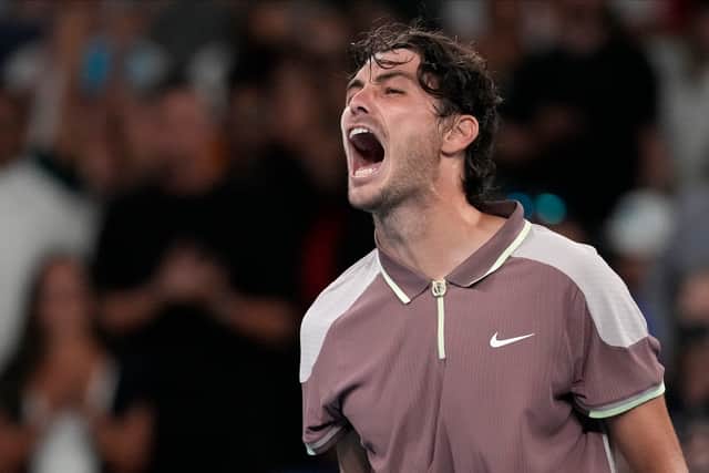 “The last couple of days has been really good so it’s going in a positive direction health wise, tennis wise, so I’m really happy.”