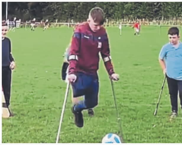 Michael Dennedy, 14, lost his leg but has not let it define him