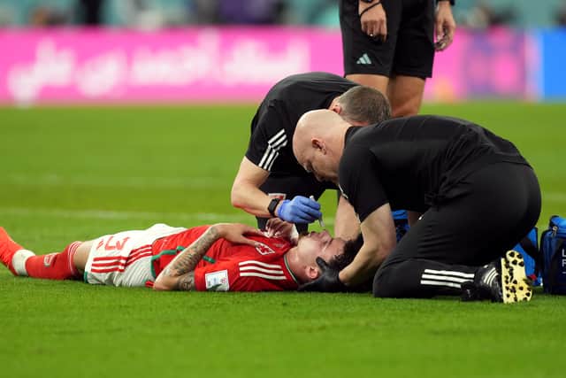 Concussion concerns