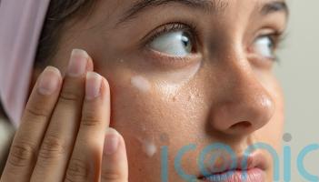 How to get rid of &lsquo;milk spots&rsquo;