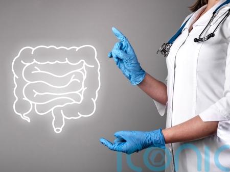 What can I expect during bowel cancer screening &ndash; and am I eligible?