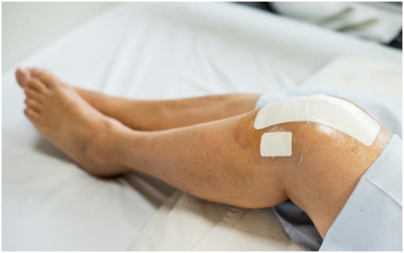 EXPLAINER Do I need physio after a Total Knee Replacement? by Laois